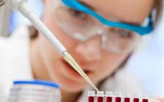 Общий и биохимический анализ крови расшифровка