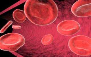 Сред сод гемоглобина понижен причины