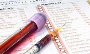 Клинический и общий анализ крови отличие