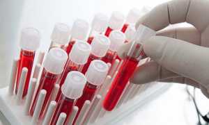 Показатели общего анализа крови расшифровка у женщин